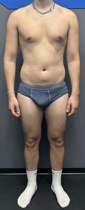 Jacopo, prima del percorso